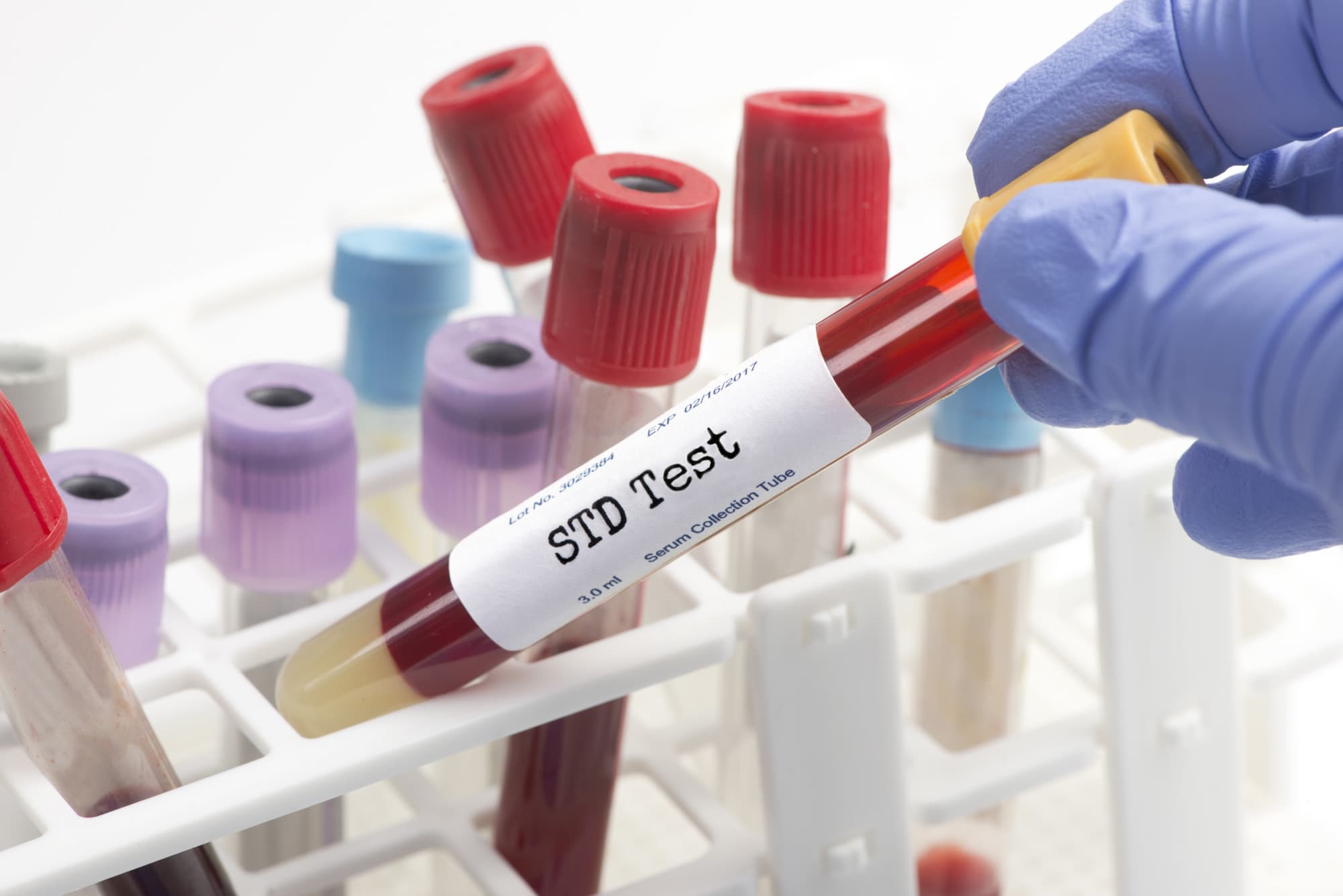 Sexually Transmitted Diseases Profile